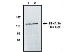 Western Blot analysis using EBV EBNA 3A Antibody on cell lines infected with Epstein Barr Virus. (EBV 抗体)