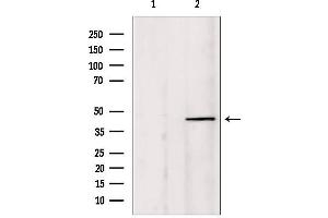 Western blot analysis of extracts from HepG2, using PIAS1 Antibody.