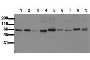 Western Blotting (WB) image for anti-SHC (Src Homology 2 Domain Containing) Transforming Protein 1 (SHC1) (N-Term) antibody (ABIN126890) (SHC1 抗体  (N-Term))