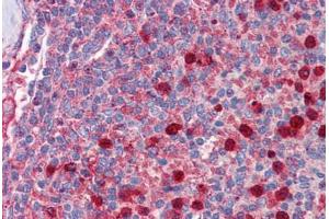 Human Spleen: Formalin-Fixed, Paraffin-Embedded (FFPE) (RPL5 抗体  (AA 35-84))