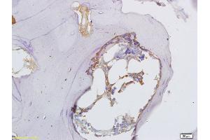 Formalin-fixed and paraffin embedded rat shin bone labeled with Anti-Osteopontin Polyclonal Antibody, Unconjugated (ABIN723800) at 1:300 followed by conjugation to the secondary antibody and DAB staining (Osteopontin 抗体  (AA 221-280))