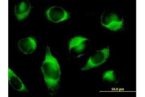 Immunofluorescence of purified MaxPab antibody to PLOD3 on HeLa cell. (PLOD3 抗体  (AA 1-738))