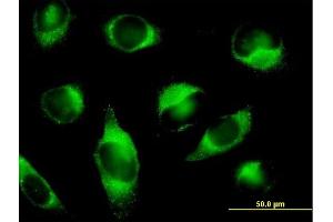 Immunofluorescence of purified MaxPab antibody to PLOD3 on HeLa cell.