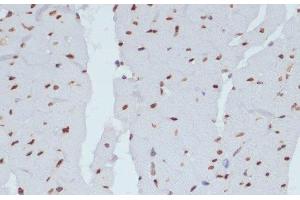 Immunohistochemistry of paraffin-embedded Rat heart using Phospho-CHEK1(S280) Polyclonal Antibody at dilution of 1:100 (40x lens). (CHEK1 抗体  (pSer280))