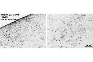 Immunohistochemistry (IHC) image for anti-Glial Fibrillary Acidic Protein (GFAP) (C-Term) antibody (ABIN185730)