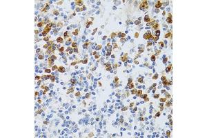 Immunohistochemistry of paraffin-embedded human tonsil using p60 C antibody  at dilution of 1:100 (40x lens). (CHAF1B 抗体  (AA 270-559))
