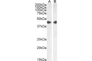 Western Blotting (WB) image for anti-Actin, alpha 2, Smooth Muscle, Aorta (ACTA2) (N-Term) antibody (ABIN185271)