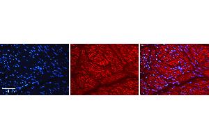 Immunohistochemistry (IHC) image for anti-Aryl Hydrocarbon Receptor (AHR) (N-Term) antibody (ABIN2777386)