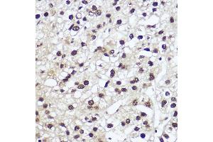 Immunohistochemistry (IHC) image for anti-Nuclear Factor I/A (NFIA) (AA 180-330) antibody (ABIN1681040)