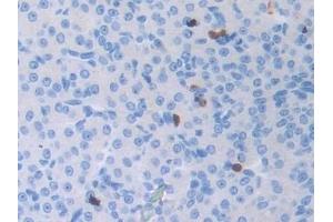 Detection of ATF6 in Mouse Ovary Tissue using Polyclonal Antibody to Activating Transcription Factor 6 (ATF6) (ATF6 抗体  (AA 1-377))