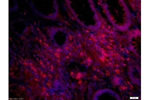 Immunofluorescence (Paraffin-embedded Sections) (IF (p)) image for anti-Interleukin 12 (IL12) (AA 51-150) antibody (ABIN734453)