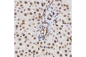 Immunohistochemistry (Paraffin-embedded Sections) (IHC (p)) image for anti-Histone 3 (H3) (H3K9me2) antibody (ABIN3023260)