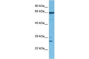 Western Blotting (WB) image for anti-Goosecoid Homeobox (GSC) (N-Term) antibody (ABIN2779490)