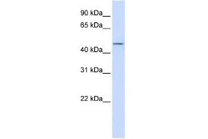 CHST6 antibody used at 1 ug/ml to detect target protein. (CHST6 抗体)