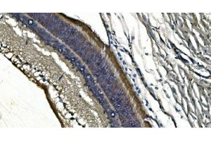 IHC analysis of PDE6 alpha/PDE6A using anti-PDE6 alpha/PDE6A antibody (ABIN7599710).