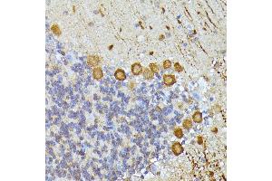 Immunohistochemistry of paraffin-embedded mouse cerebellum using K/K/Elp3 antibody (ABIN6130883, ABIN6140142, ABIN6140143 and ABIN6225217) at dilution of 1:100 (40x lens). (ELP3/KAT9 抗体  (AA 358-547))