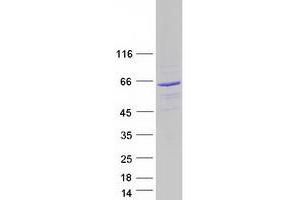 Validation with Western Blot (SACM1L Protein (Myc-DYKDDDDK Tag))