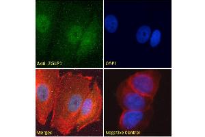 ABIN570846 Immunofluorescence analysis of paraformaldehyde fixed MCF7 cells, permeabilized with 0.