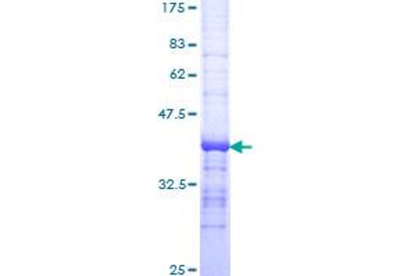 DNASE2 Protein (AA 261-360) (GST tag)