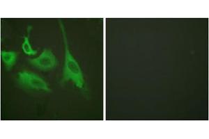 Immunofluorescence analysis of HeLa cells, treated with TNF-a (20nM, 15mins), using HSP90B (phospho-Ser254) antibody (ABIN5975888). (HSP90AB1 抗体  (pSer254))