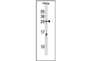 Western blot analysis of PPP1R2 Antibody (PPP1R2 抗体  (Middle Region))