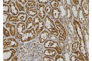 ABIN6272923 at 1/100 staining Human kidney tissue by IHC-P. (LGALS3BP 抗体  (C-Term))