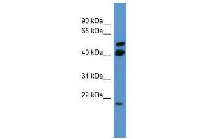 RERG antibody used at 0. (RERG 抗体  (C-Term))