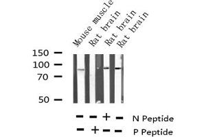 Western blot analysis of Phospho-SP1 (Thr739) expression in various lysates