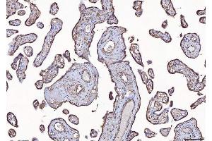 IHC analysis of Eph Receptor A3/EPHA3 using anti-Eph Receptor A3/EPHA3 antibody (ABIN7602102).
