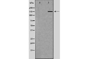 Western blot analysis of Hela whole cell lysates, using RAD50 Antibody. (RAD50 抗体  (Internal Region))