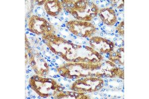 Immunohistochemistry of paraffin-embedded Mouse kidney using [KO Validated] CHCHD2 Rabbit pAb (ABIN7266448) at dilution of 1:100 (40x lens). (CHCHD2 抗体  (AA 75-145))