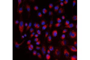 IF analysis of ALDH1A2 using anti-ALDH1A2 antibody (ABIN4886449). (ALDH1A2 抗体  (AA 1-110))