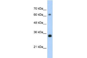 Western Blotting (WB) image for anti-Proliferating Cell Nuclear Antigen (PCNA) (C-Term) antibody (ABIN2792157)