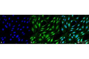 Immunocytochemistry/Immunofluorescence analysis using Mouse Anti-Ubiquitin Monoclonal Antibody, Clone FK2 . (Ubiquitin 抗体  (Biotin))