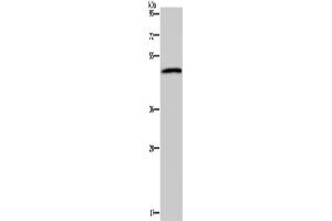 Western Blotting (WB) image for anti-Serotonin Receptor 2B (HTR2B) antibody (ABIN2827528) (Serotonin Receptor 2B 抗体)