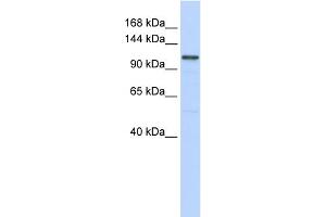 WB Suggested Anti-ADCY8 Antibody Titration:  0. (ADCY8 抗体  (Middle Region))