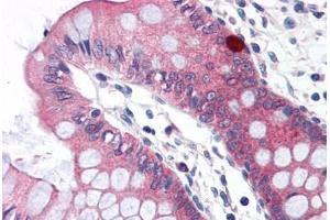 Human Colon (formalin-fixed, paraffin-embedded) stained with CLDN5 antibody ABIN364455 at 15 ug/ml followed by biotinylated goat anti-rabbit IgG secondary antibody ABIN481713, alkaline phosphatase-streptavidin and chromogen. (Claudin 5 抗体  (C-Term))