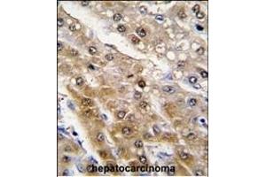 Immunohistochemistry (Paraffin-embedded Sections) (IHC (p)) image for anti-Aldehyde Dehydrogenase 9 Family, Member A1 (ALDH9A1) (AA 4-34), (N-Term) antibody (ABIN6242161)