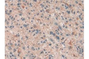 Immunohistochemistry (IHC) image for anti-Complement Component 6 (C6) (AA 682-934) antibody (ABIN7435277)