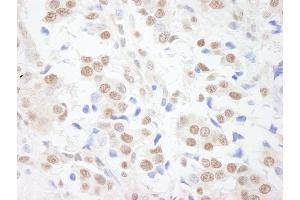 anti-Scaffold Attachment Factor B (SAFB) (AA 775-825) antibody