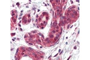 IHC analysis of FFPE human breast tissue stained with SLUG antibody (SLUG 抗体  (AA 98-129))
