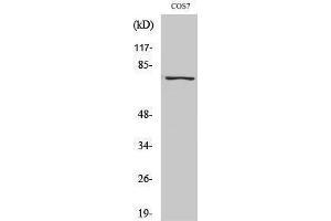 Western Blotting (WB) image for anti-Nuclear Factor-kB p65 (NFkBP65) (pSer529) antibody (ABIN3182088) (NF-kB p65 抗体  (pSer529))