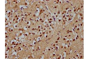 IHC image of ABIN7171755 diluted at 1:100 and staining in paraffin-embedded human brain tissue performed on a Leica BondTM system. (ODZ1/Teneurin 1 抗体  (AA 1-241))