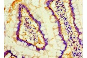 Immunohistochemistry of paraffin-embedded human small intestine tissue using ABIN7160116 at dilution of 1:100 (MOB1A 抗体  (AA 2-216))