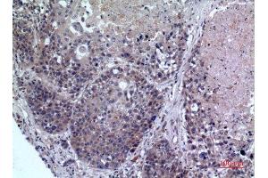 Immunohistochemistry (IHC) analysis of paraffin-embedded Human Lung, antibody was diluted at 1:100. (FMO3 抗体  (Internal Region))