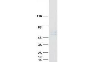 Western Blotting (WB) image for Carboxypeptidase B2 (Plasma) (CPB2) (Transcript Variant 1) protein (Myc-DYKDDDDK Tag) (ABIN2713153)
