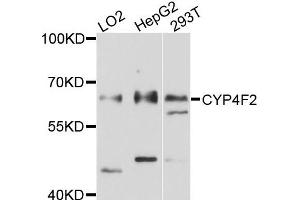 Western blot analysis of extracts of various cells, using CYP4F2 antibody. (CYP4F2 抗体)