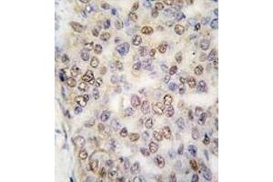 Image no. 2 for anti-Actinin, alpha 4 (ACTN4) (N-Term) antibody (ABIN360099) (alpha Actinin 4 抗体  (N-Term))