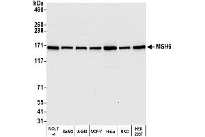 Western Blotting (WB) image for anti-MutS Homolog 6 (E. Coli) (MSH6) (AA 1310-1360) antibody (ABIN7455152)