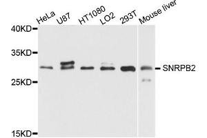 Western blot analysis of extract of various cells, using SNRPB2 antibody. (SNRPB2 抗体)